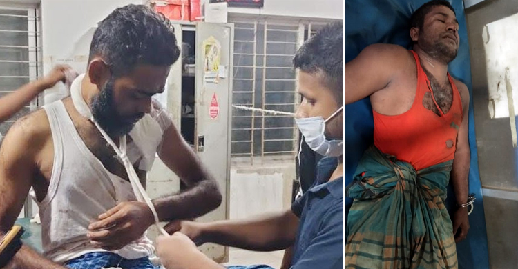 ফ্রিজের পেছনে লুকিয়ে ছিল চোর, আটকাতে গিয়ে ছুরিকাঘাতে আহত ২