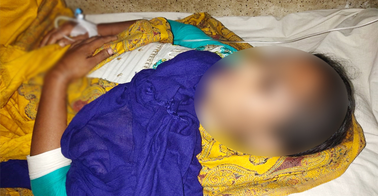 অ্যাসিড নিক্ষেপে ঝলসে গেলো গৃহবধূর মুখ