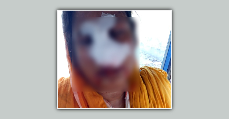 সিদ্ধিরগঞ্জে জমি দখল নিতে বিধবাকে হত্যাচেষ্টা