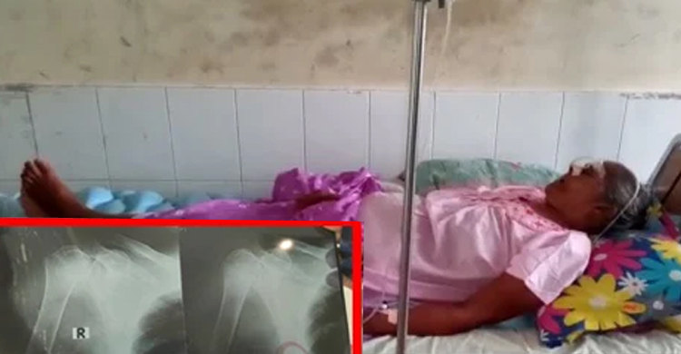 ডায়াগনস্টিকে পরীক্ষার সময় বৃদ্ধার হাত ভাঙার অভিযোগ