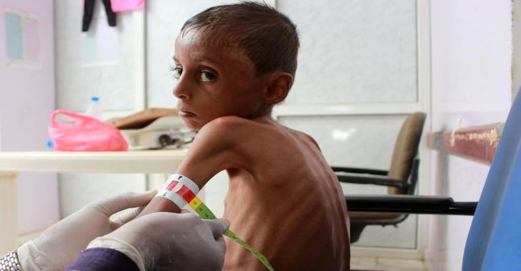 Yemen's children starve amid rising fears of famine