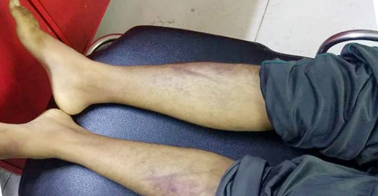 BUET student found dead, 2 detained