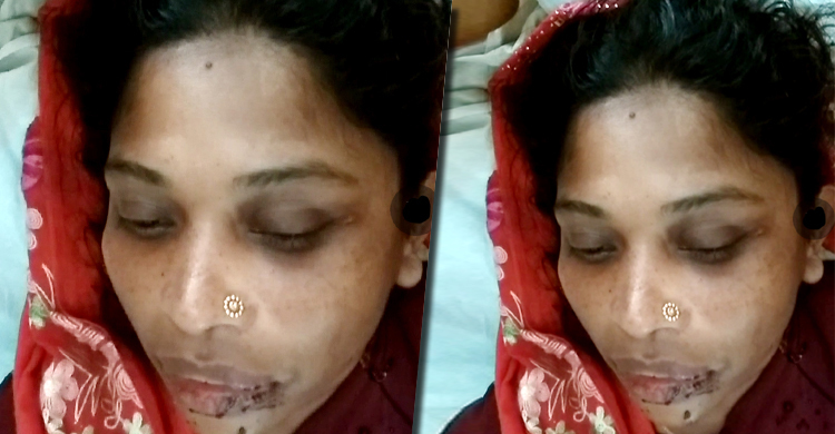 গলায় বোরকা পেঁচিয়ে রাস্তায় ফেলে স্ত্রীকে মারধর করলেন স্বামী