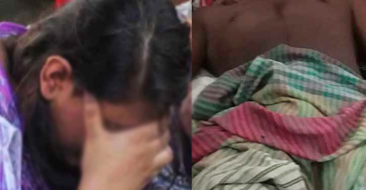 পরকীয়া সন্দেহে স্বামীর পুরুষাঙ্গ কেটে দিলেন স্ত্রী