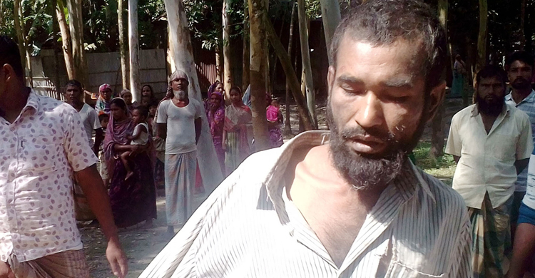 ইট দিয়ে শিশুর মাথা থেঁতলে দিলো যুবক