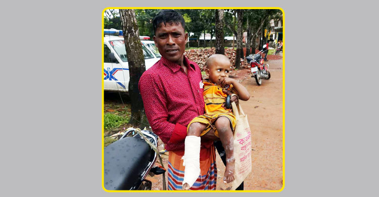 শিশুর ভাঙা পা রেখে ভালো পায়ে প্লাস্টার