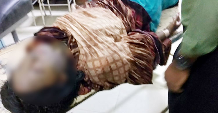 থানার বাইরে গায়ে আগুন দেয়া সেই তরুণীর মৃত্যু