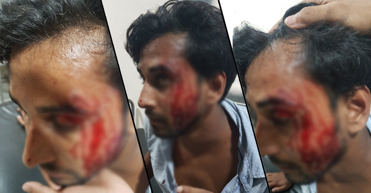 র্যাগিংয়ের প্রতিবাদ করায় শিক্ষার্থীকে মারধরের অভিযোগ