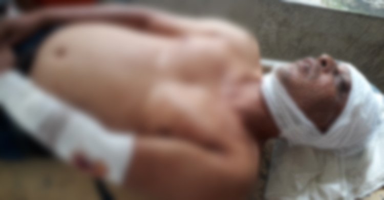 স্বেচ্ছাসেবক লীগ নেতাকে চাপাতি দিয়ে কোপালেন আ.লীগ নেতা