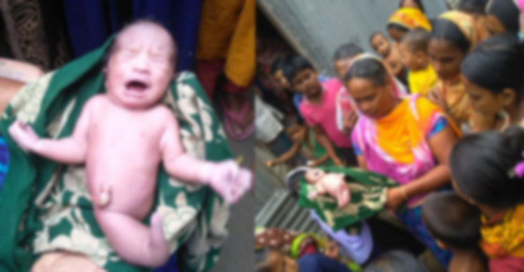 এক পা নিয়ে অদ্ভুত শিশুর জন্ম