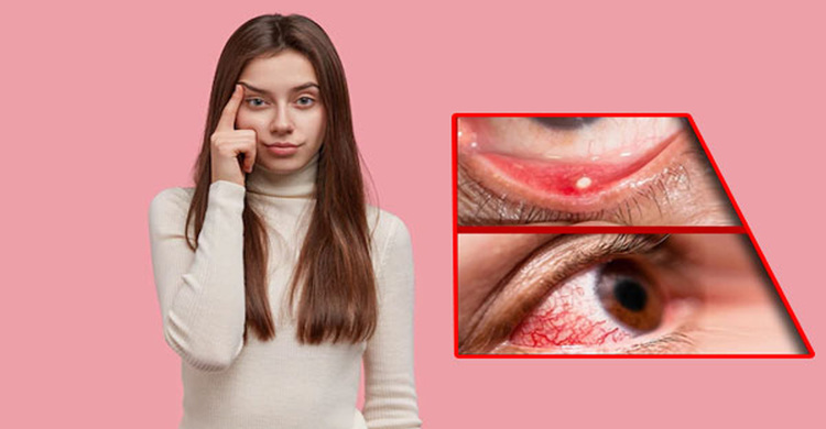 শীতকালে চোখের রোগ বা সমস্যাগুলো কী কী?