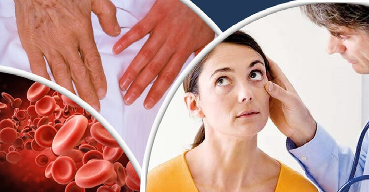 অ্যানিমিয়া থাকলে কি রোজা রাখা যাবে?