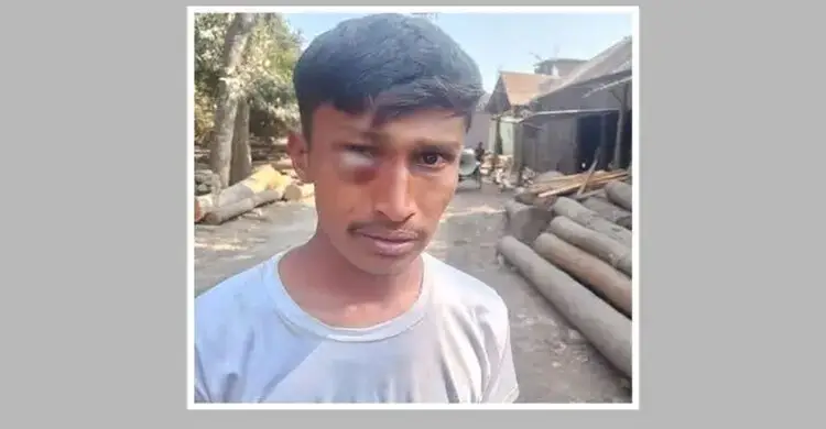 জামায়াতের নির্বাচনি প্রচারণায় বাধা, ভ্যানচালকের চোখে গুরুতর আঘাত