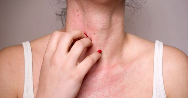 সোনায় অ্যালার্জি বুঝবেন কীভাবে, কী করবেন