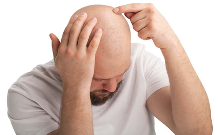 সিরাম কি পারবে ২০ দিনে চুল গজাতে যা বলছেন গবেষকরা