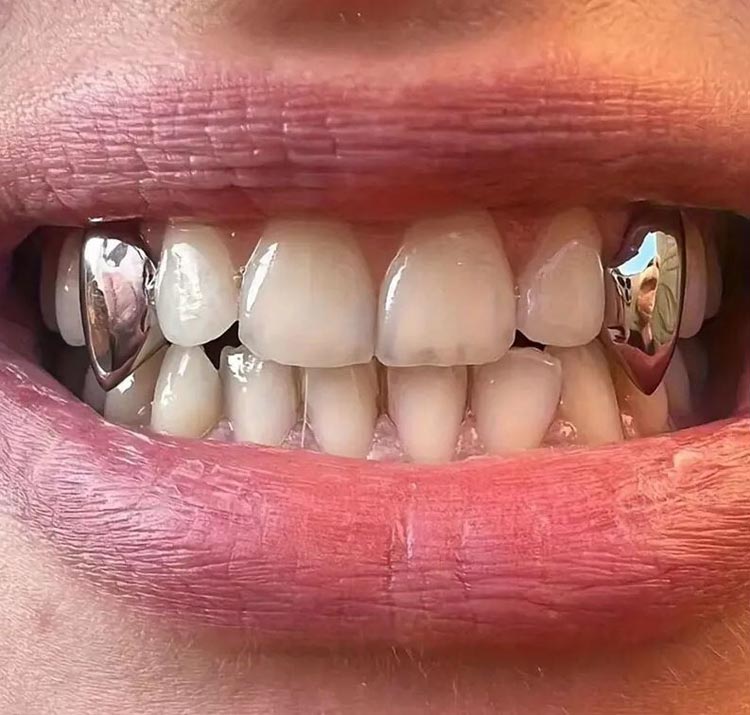 ভ্যাম্পায়ার দাঁত ট্রেন্ডে সৌন্দর্যের অন্য রূপ