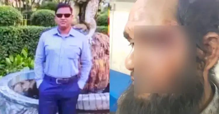 ‘আমি পুলিশ, মারলেও বিচার নাই’ চাচাতো ভাইকে রক্তাক্তের পর এএসআই