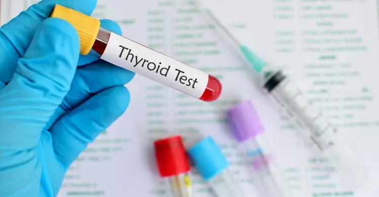 থাইরয়েডের সমস্যায় শরীর যেসব সংকেত দেয়