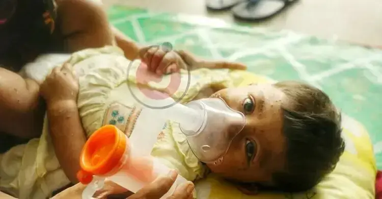 হামে আক্রান্ত হয়ে আরও দুই মৃত্যু, নতুন রোগী ৭৮৭