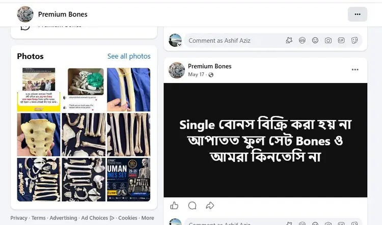 ফেসবুকে ঘোষণা দিয়ে বিক্রি হচ্ছে কঙ্কাল