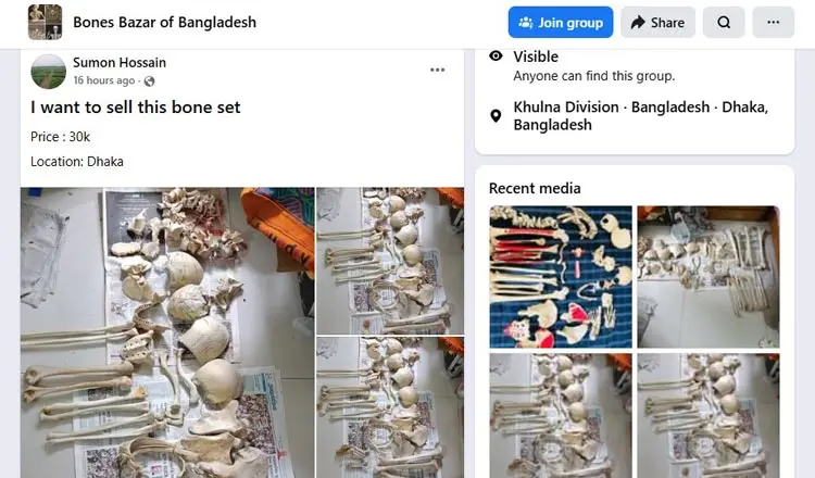 ফেসবুকে ঘোষণা দিয়ে বিক্রি হচ্ছে কঙ্কাল