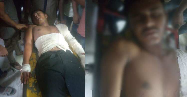 মুন্সিগঞ্জে গুলিবিদ্ধ শিশুসহ তিনজনকে ঢাকা মেডিকেলে ভর্তি