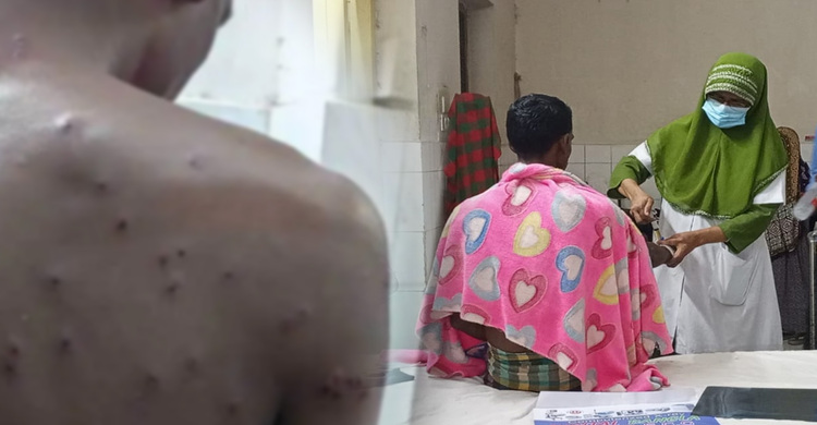 চুয়াডাঙ্গা সীমান্তে বিএসএফের গুলিতে বাংলাদেশি আহত