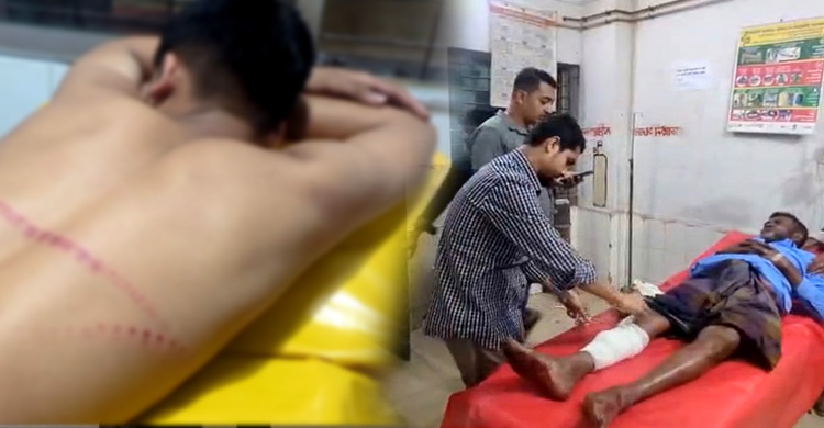 লক্ষ্মীপুরে দুই গ্রুপের মধ্যে গোলাগুলি, পথচারী গুলিবিদ্ধ