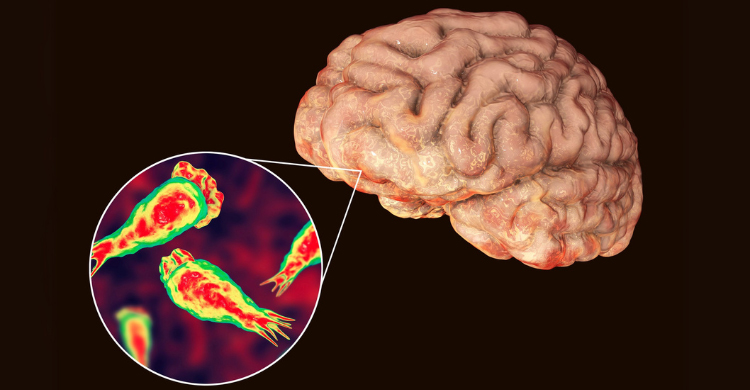 লক্ষণগুলো শুরু হওয়ার পর বেশিরভাগ রোগী ১ থেকে ১৮ দিনের মধ্যে মারা যান। ছবি/প্রতীকী
