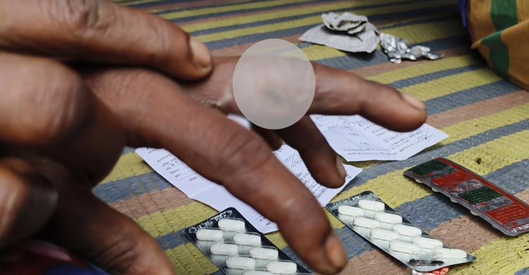 মেহেরপুরে অসুস্থ পশুর মাংস থেকে ছড়িয়ে পড়ছে অ্যানথ্রাক্স