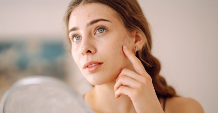 হাত ধোয়ার অভ্যাস কমাতে পারে ত্বকের ব্রণ