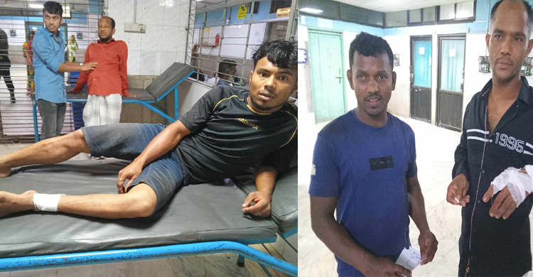 কোরবানি দিতে গিয়ে হাত কেটে পা কেটে ঢাকা মেডিকেলে ৭০