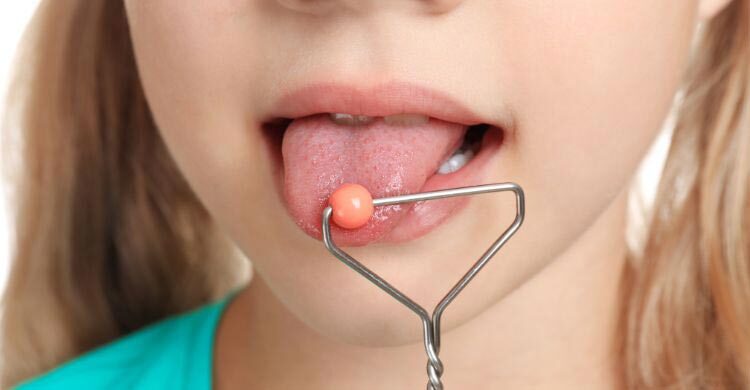 তোতলামি কোনো রোগ নয়, সহজেই ভালো হয়