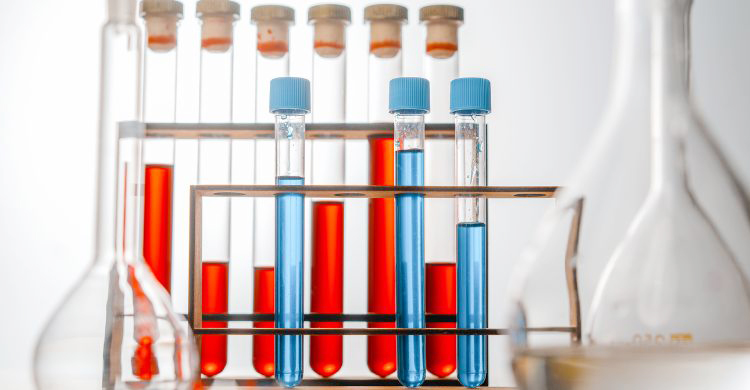 তিন মাসের ডায়াবেটিসের হিসাব একবারে পাবেন যে রক্ত পরীক্ষায়