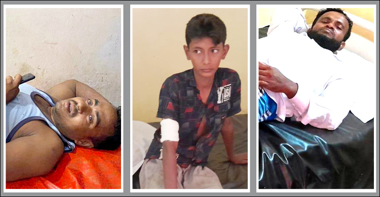 রাঙ্গামাটিতে শূকরের কামড়ে আহত ৩