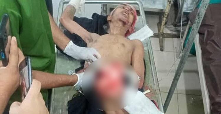রায়েরবাজারে কিশোর গ্যাংয়ের সংঘর্ষ, যুবকের বাম পা বিচ্ছিন্ন