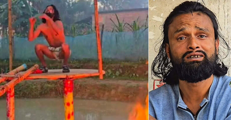 কনটেন্ট বানাতে গিয়ে অগ্নিদগ্ধ আল-আমিন বার্ন ইউনিটে