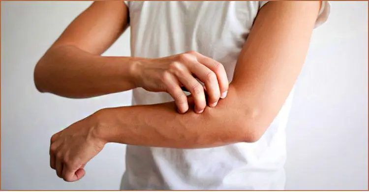 ত্বকে হঠাৎ চুলকানি ও র‍্যাশ? স্কিন অ্যালার্জি নাকি অন্য কিছু