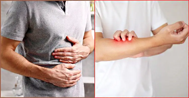 খাবারে অ্যালার্জি নাকি হজমের সমস্যা? পার্থক্য জানুন