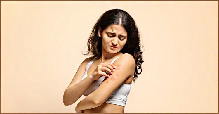 ত্বকে হঠাৎ চুলকানি ও র‍্যাশ? স্কিন অ্যালার্জি নাকি অন্য কিছু