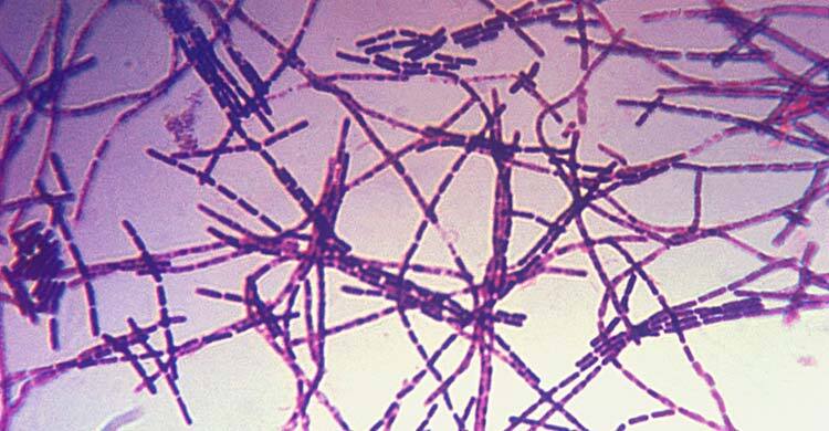 গাইবান্ধায় অ্যানথ্রাক্সের উপসর্গ নিয়ে নারীর মৃত্যু