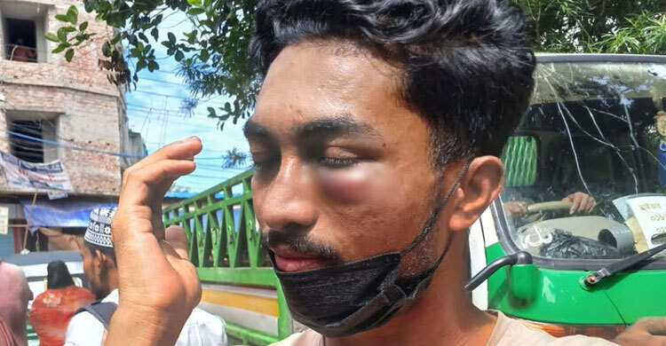 অস্ত্রের মুখে মুরগি ব্যবসায়ীকে অপহরণ, পরে উদ্ধার করে পুলিশ
