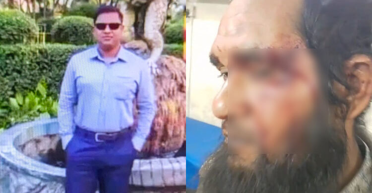 ‘আমি পুলিশ, মারলেও বিচার নাই’ চাচাতো ভাইকে রক্তাক্তের পর এএসআই