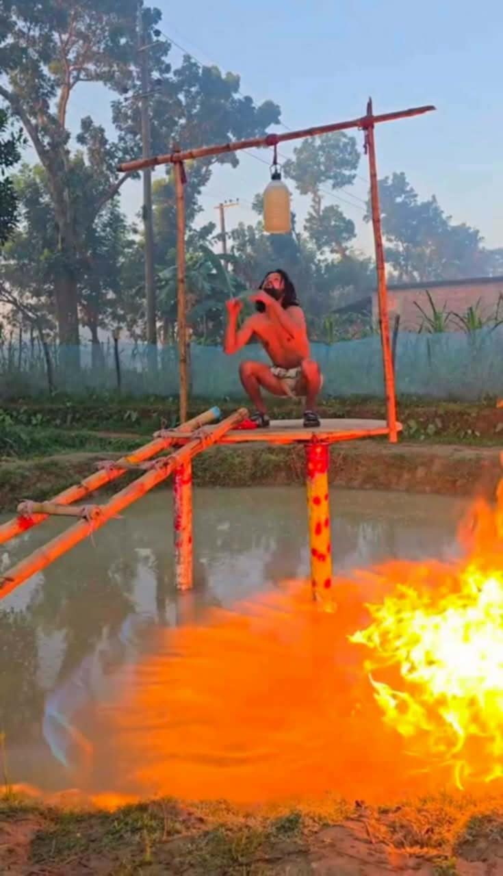 কনটেন্ট বানাতে গিয়ে অগ্নিদগ্ধ আল-আমিন বার্ন ইউনিটে