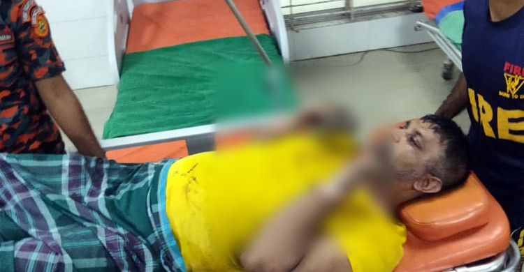 রাসায়নিক গুদামে আগুন, নেভাতে গিয়ে ফায়ার সার্ভিসের ৫ কর্মী দগ্ধ