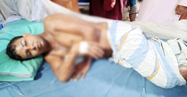 শিঙাড়ার বিল চাওয়ায় হোটেলমালিকের শরীরে গরম তেল ঢেলে দিলেন ক্রেতা