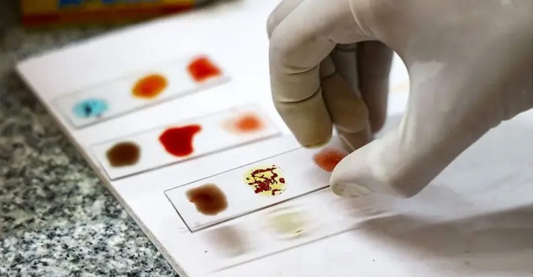 বিশ্বের সবচেয়ে বিরল রক্তের গ্রুপ কোনটি ও কেন?