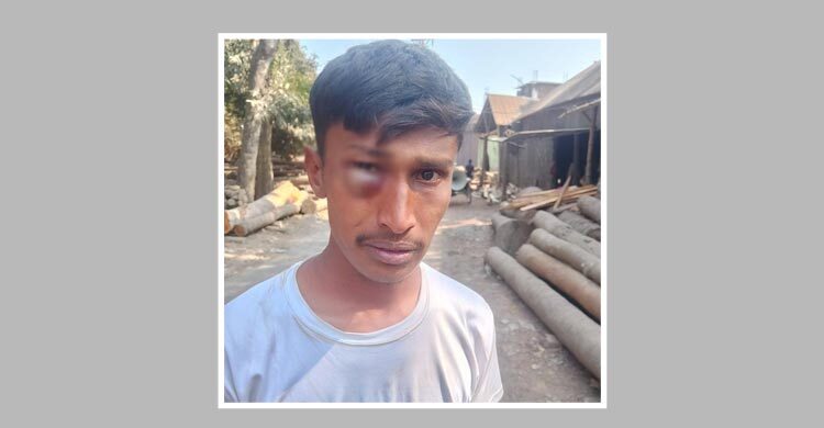 জামায়াতের নির্বাচনি প্রচারণায় বাধা, ভ্যানচালকের চোখে গুরুতর আঘাত