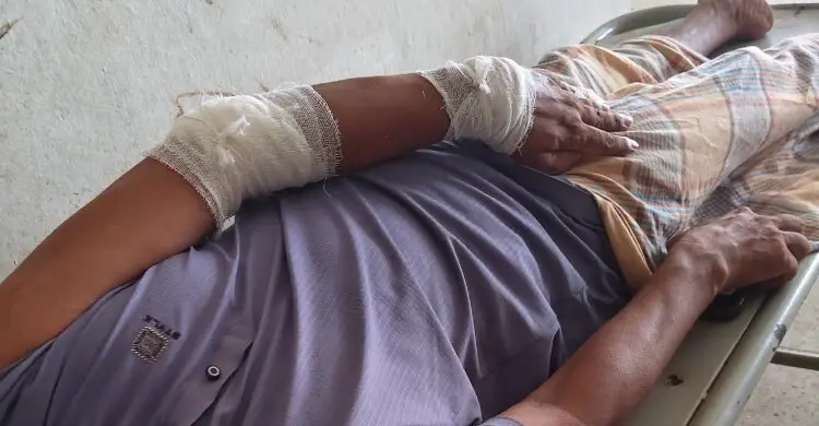 পটিয়ায় চাঁদা না দেয়ায় বিএনপি নেতাকে কুপিয়ে জখম