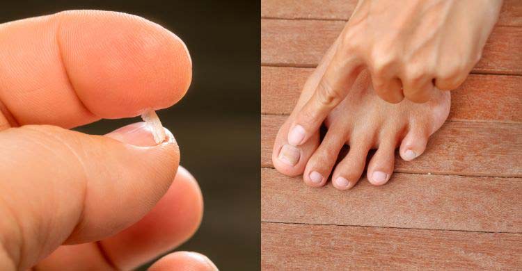 নখ ভেঙে যাচ্ছে? কোন পুষ্টি দরকার, কিসে পাবেন